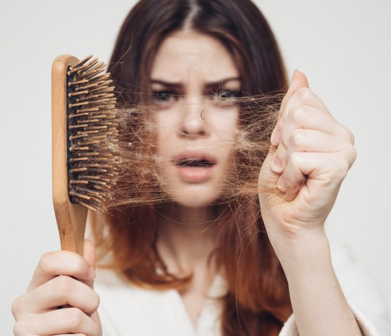 Caduta dei Capelli
